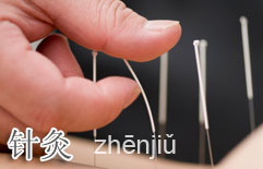 Chinese Medicine:  Acupuncture, Cupping and Scraping | ChinesePod