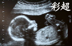 Pregnancy Series 5: Super Babies and Ultrasounds | ChinesePod