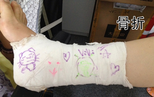 Broken Bone | ChinesePod