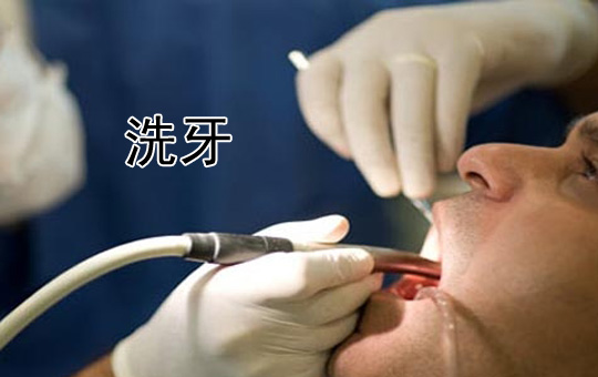 Teeth Cleaning | ChinesePod